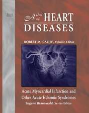 Atlas of Heart Diseases: Acute Myocardial Infarction and Other Acute Ischemic Syndromes