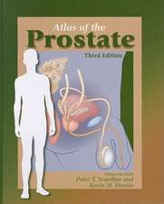 Atlas of the Prostate