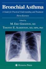 Bronchial Asthma: A Guide for Practical Understanding and Treatment