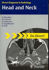 Head and Neck Imaging