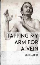 Tapping My Arm for a Vein