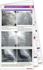 Bavry, A: Angiography Pocketcard Set