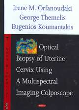 Optical Biopsy of Uterine Cervix Using a Multispectral Imaging Colposcope