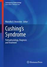 Cushing's Syndrome: Pathophysiology, Diagnosis and Treatment