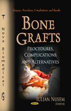 Bone Grafts