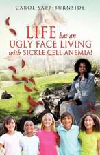 Life Has an Ugly Face Living with Sickle Cell Anemia!