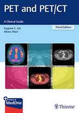 PET and PET/CT – A Clinical Guide