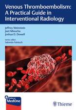 Practical Guides in Interventional Radiology – Venous Thromboembolism