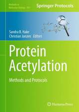 Protein Acetylation: Methods and Protocols