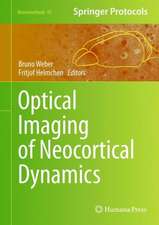 Optical Imaging of Neocortical Dynamics