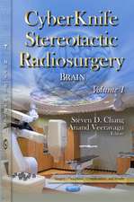 Cyberknife Stereotactic Radiosurgery