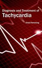 Diagnosis and Treatment of Tachycardia