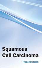 Squamous Cell Carcinoma