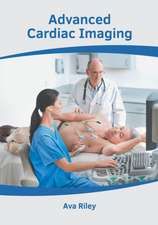 Advanced Cardiac Imaging