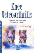 Knee Osteoarthritis