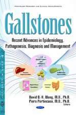 Gallstones