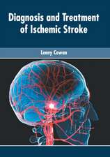 Diagnosis and Treatment of Ischemic Stroke