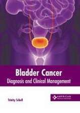 Bladder Cancer: Diagnosis and Clinical Management