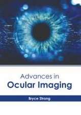 Advances in Ocular Imaging