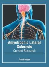 Amyotrophic Lateral Sclerosis: Current Research