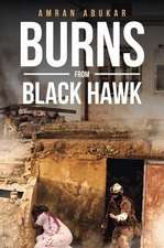 Burns from Black Hawk