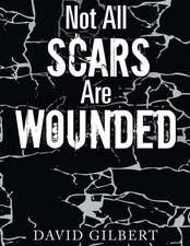 Not All Scars Are Wounded