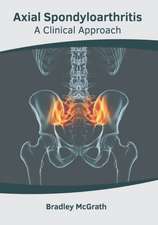 Axial Spondyloarthritis: A Clinical Approach