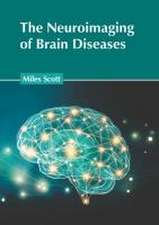 The Neuroimaging of Brain Diseases