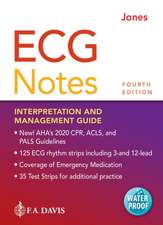 ECG Notes