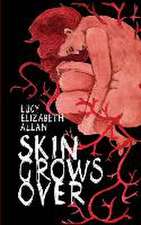 Allan, L: Skin Grows Over