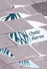 Optic Nerve