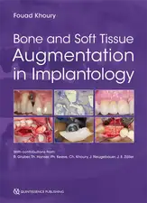 Bone and Soft Tissue Augmentation in Implantology