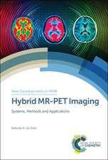 Hybrid Mr-Pet Imaging