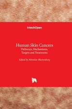 Human Skin Cancers