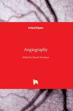 Angiography