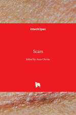 Scars