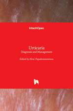 Urticaria