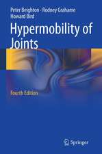 Hypermobility of Joints