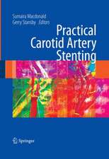 Practical Carotid Artery Stenting