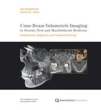 Cone Beam Volumetric Imaging in Dental, Oral and Maxillofacial Medicine: Fundamentals, Diagnostics and Treatment Planning