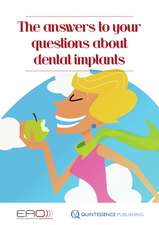 The answers to your questions about dental implants