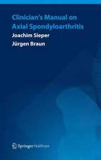 Clinician’s Manual on Axial Spondyloarthritis