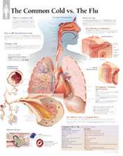 The Common Cold Vs Flu Chart: Laminated Wall Chart