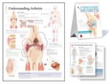 Understanding Arthritis Study Set