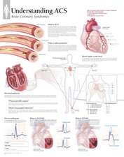 Understanding Acs Wall Chart: 8650