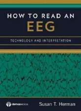 How to Read an Eeg