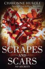 Scrapes and Scars