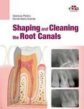 Plotino, G: Shaping and Cleaning the Root Canals