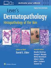 Lever's Dermatopathology: Histopathology of the Skin