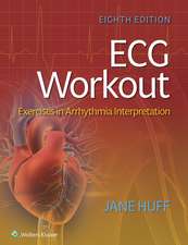 ECG Workout: Exercises in Arrhythmia Interpretation